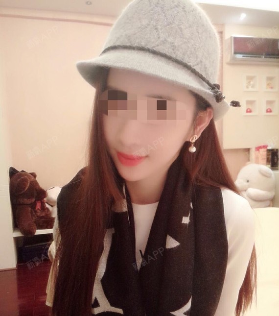 上海虹桥医院皮肤科肉毒素去狐臭第0天美丽日