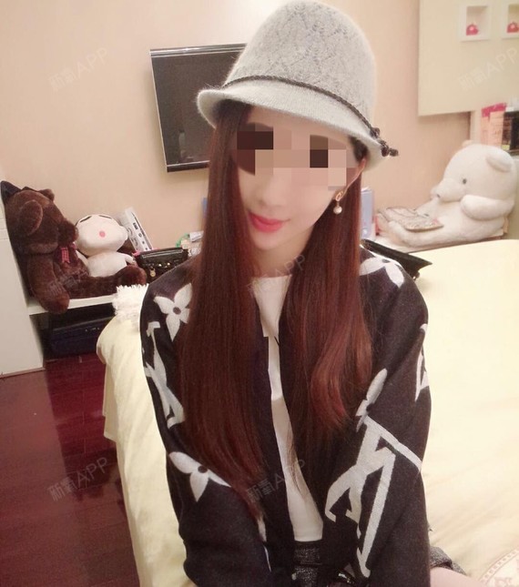 上海虹桥医院皮肤科肉毒素去狐臭第0天美丽日