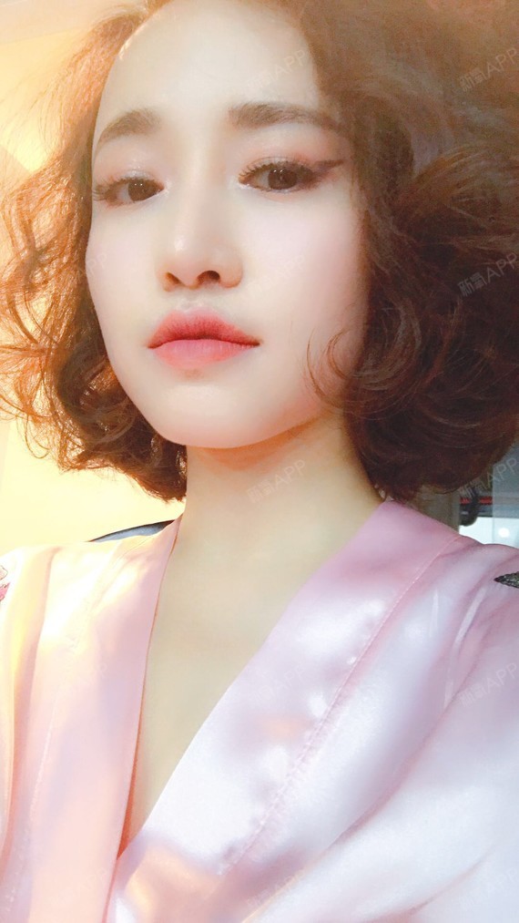 少女怪物史莱克自体脂肪全脸填充第79天美丽