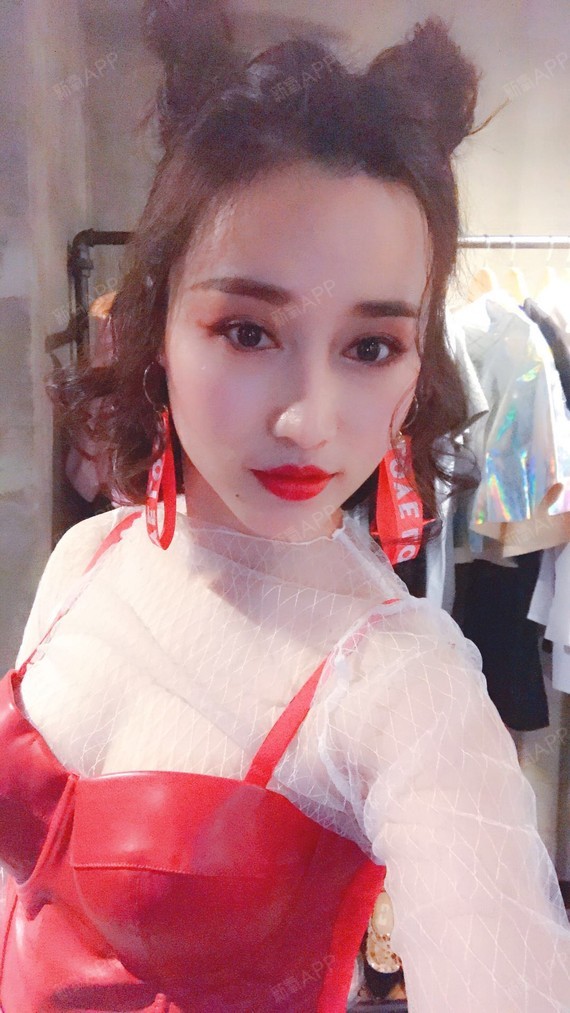 少女怪物史莱克自体脂肪全脸填充第79天美丽