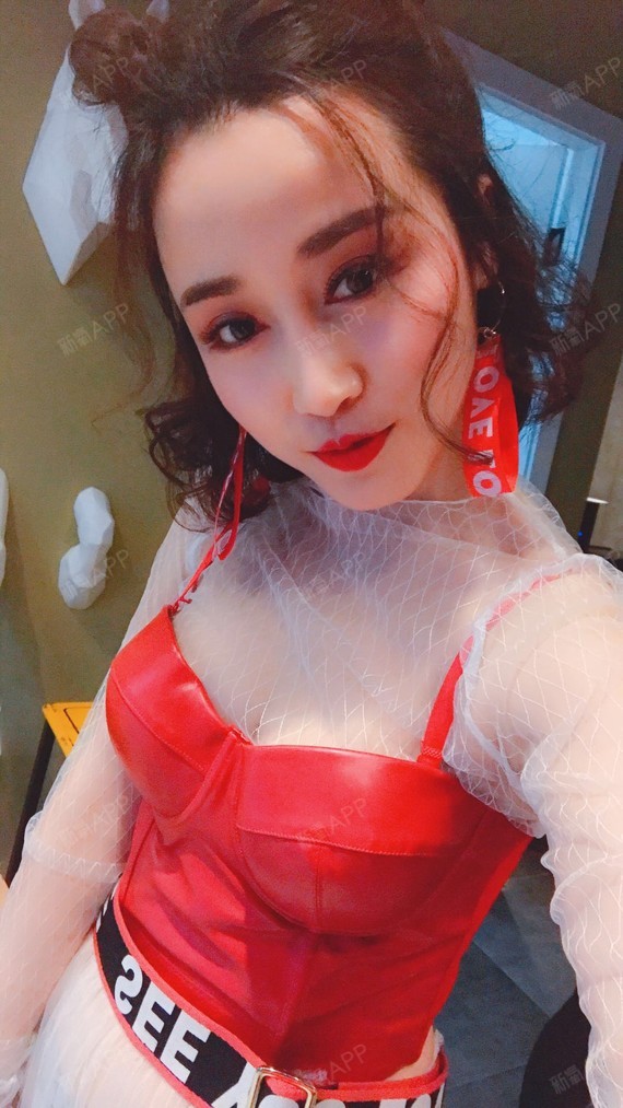 少女怪物史莱克自体脂肪全脸填充第79天美丽