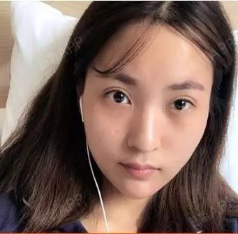 凹凹的脸颊、干瘪的苹果肌、扁塌的眼窝…小姐