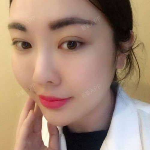 靓女玻尿酸垫下巴第61天美丽日记-新氧美容整