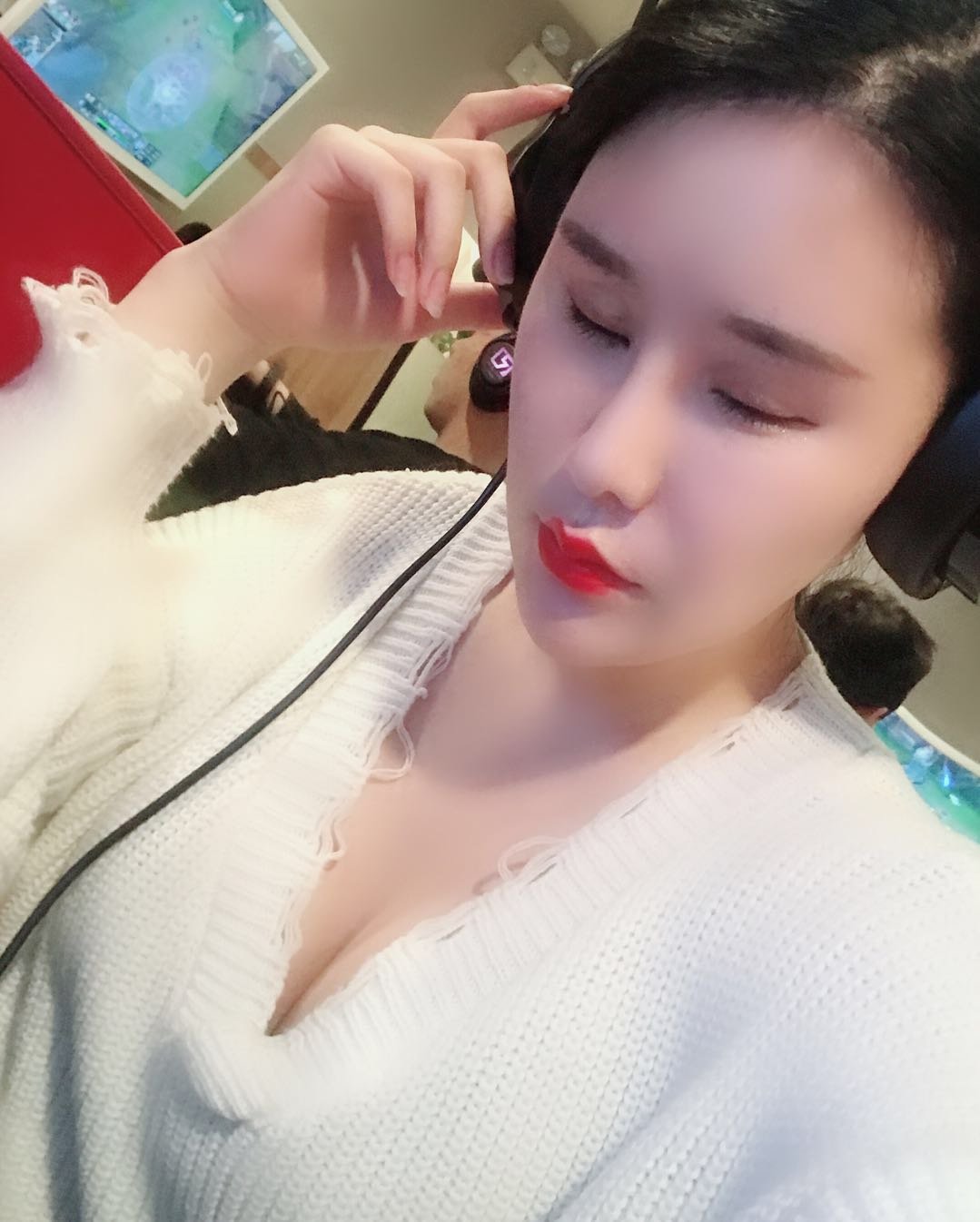 自体脂肪隆胸第9天