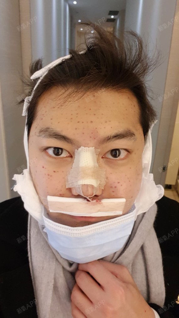 ow | 眼部 | 鼻部 | 面部轮廓 | 激光美肤 | 开眼角 |