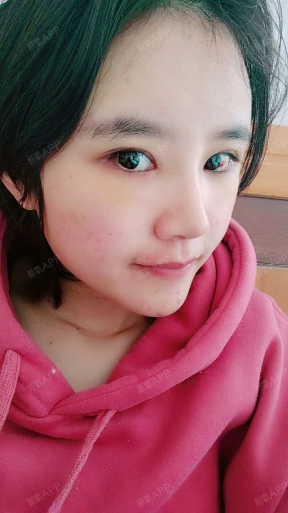 名够长才配做李泽言的女人鼻综合第13天美丽