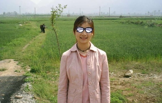 上海虹桥医院腋臭科肉毒素去狐臭第2天美丽日