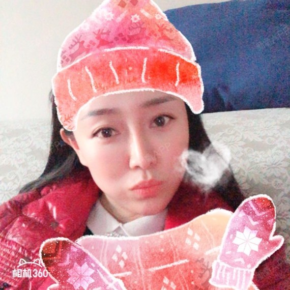 玉湖冰心自体脂肪全脸填充第44天美丽日记-新