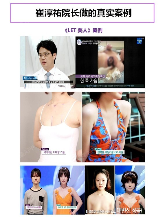 新氧 - 新氧韩国服务站 | 胸部 | 隆胸 | 乳头 | 乳房缩小 | 去副乳 | 假体隆胸 | 乳头整形 | 自体脂肪隆胸 | 吸脂去副乳 | 胸部修复 | 韩国整形 | 乳晕 | 乳晕漂红 | KOREA医生面对面 | 乳晕缩小 | 组团儿一起去韩国 新氧 - 新氧韩国服务站 | 胸部 | 隆胸 | 乳头 | 乳房缩小 | 去副乳 | 假体隆胸 | 乳头整形 | 自体脂肪隆胸 | 吸脂去副乳 | 胸部修复 | 韩国整形 | 乳晕 | 乳晕漂红 | KOREA医生面对面 | 乳晕缩小 | 组团儿一起去韩国