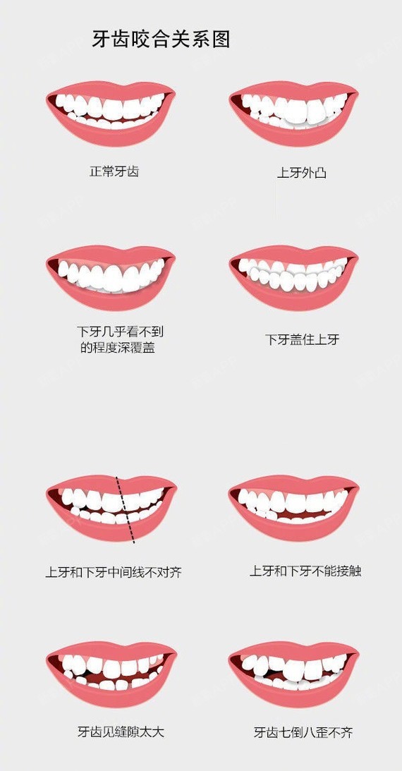 【你的牙齿是哪一种类型】