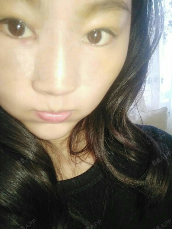 考不上大学去抗日硅胶隆鼻第2天美丽日记-新氧