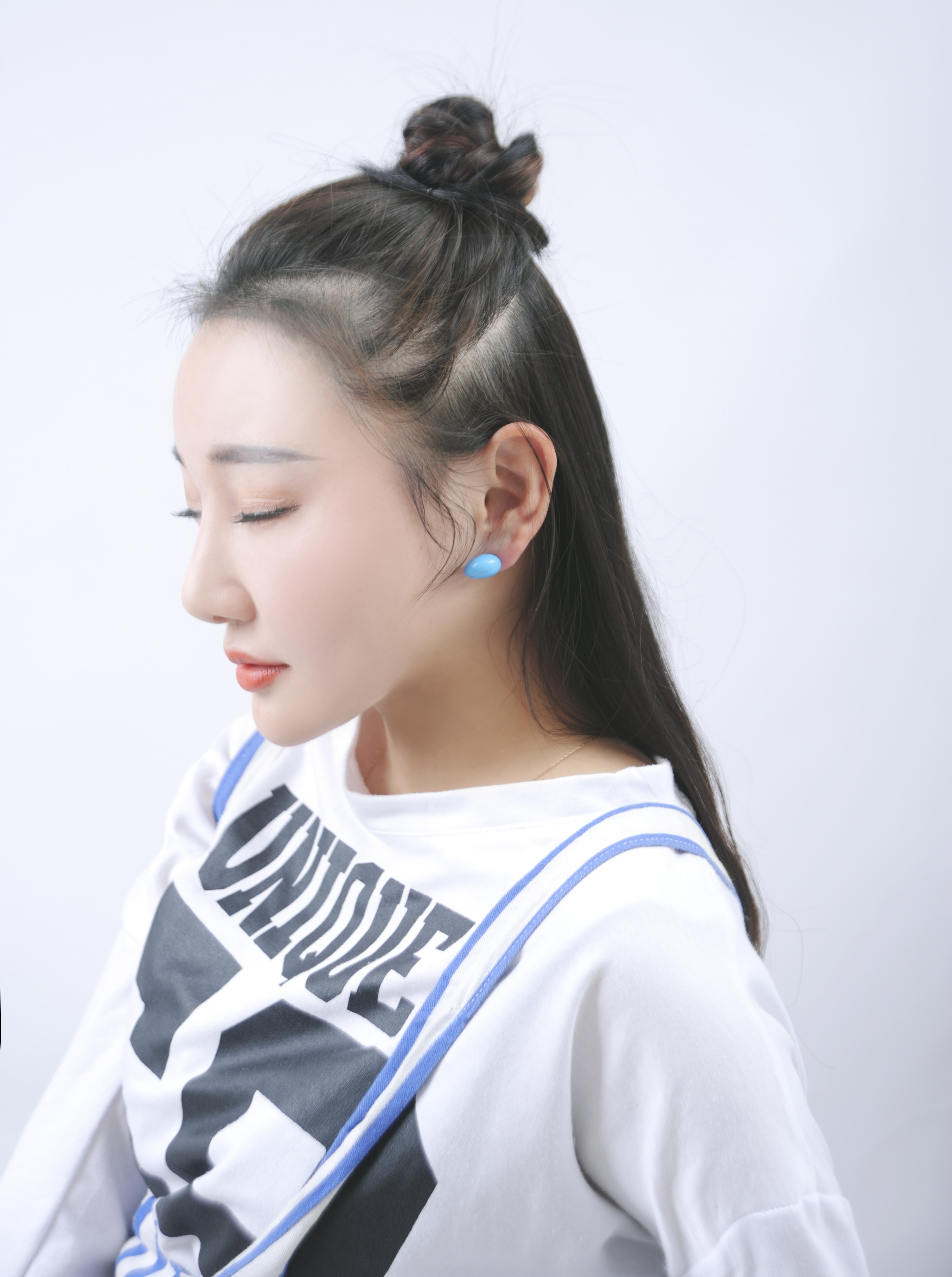 合肥恒美整形美容医院自体脂肪全脸填充怎么样