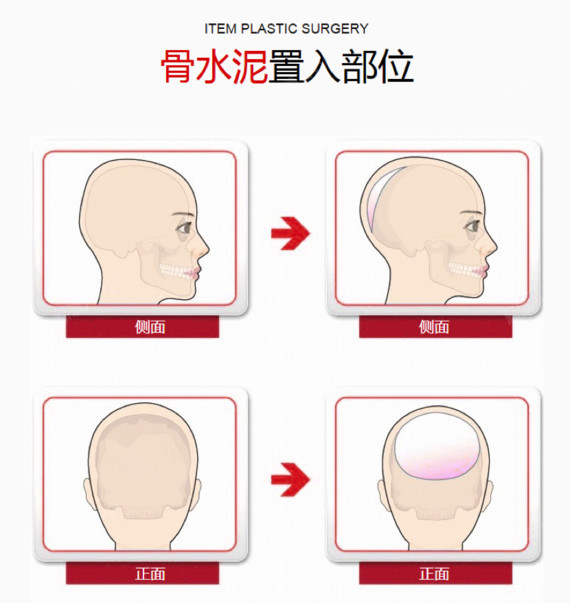 item爱婷整形医院美丽日记