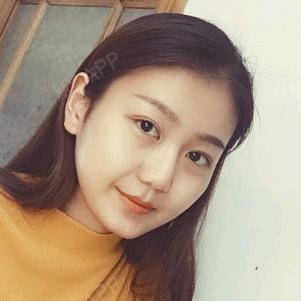 sunny_tank眼部综合第13天美丽日记-新氧美容