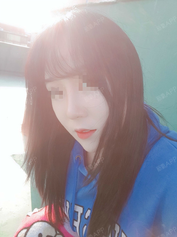 上海模特经纪TF鼻综合第35天美丽日记-新氧美