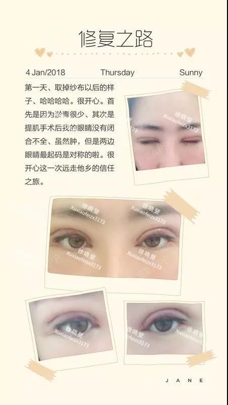 鼻子有大坑修复多少钱