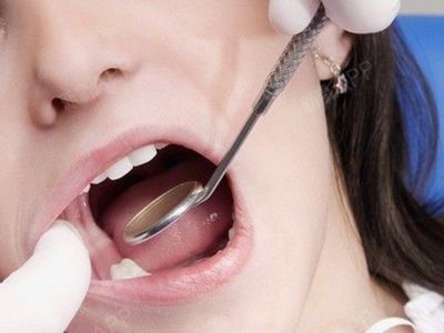 独孤郎郎拔牙第162天美丽日记-新氧美容整形