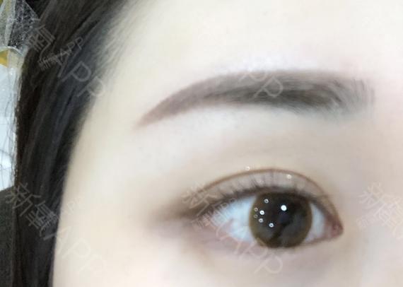 code.monkey半永久纹眉第20天美丽日记-新氧美容整形
