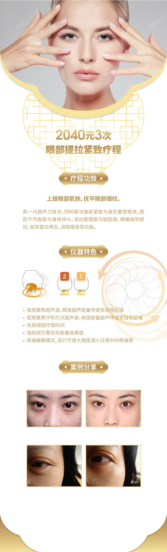 【射频紧肤】【抗衰祛皱】眼部提拉紧致疗程 2040元3次,时光逆转,效果