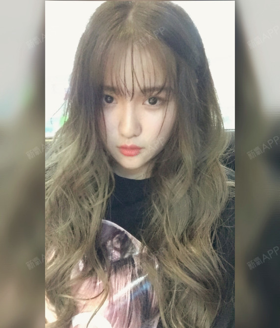 一碗叉烧面部吸脂第132天美丽日记-新氧美容整