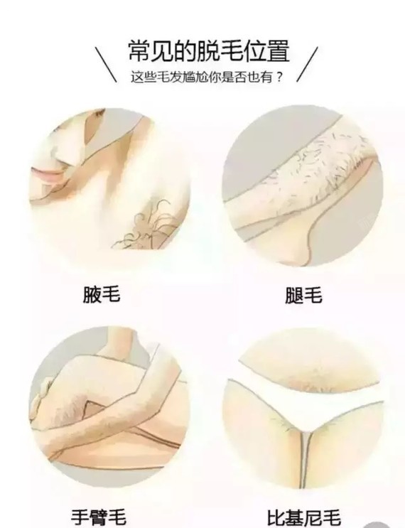 冰点脱毛