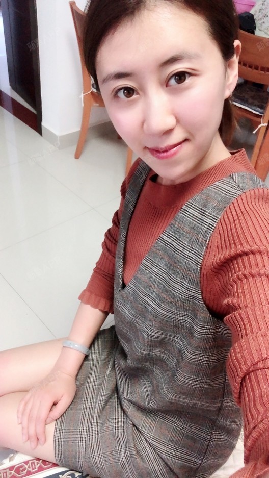 小欠不蹬自体脂肪全脸填充第190天美丽日记-新