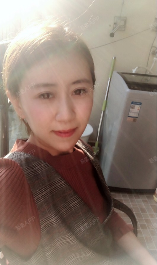 小欠不蹬自体脂肪全脸填充第190天美丽日记-新