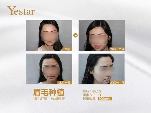 古诗云:春种一粒粟,秋收万颗子!也是耕种的好时