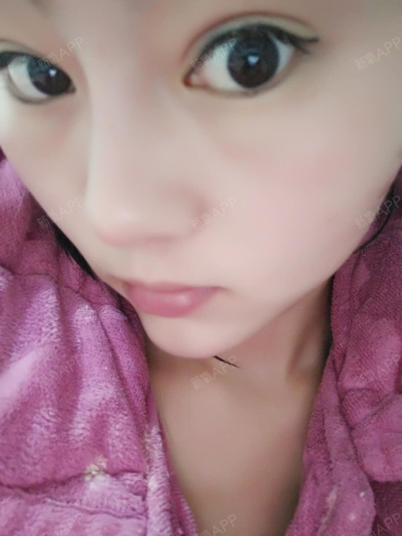 考不上大学去抗日硅胶隆鼻第43天美丽日记-新