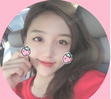 Guolihahaha玻尿酸导入第0天美丽日记-新氧美