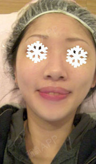 吹吧吹吧我的骄傲放纵镭射净肤第0天美丽日记