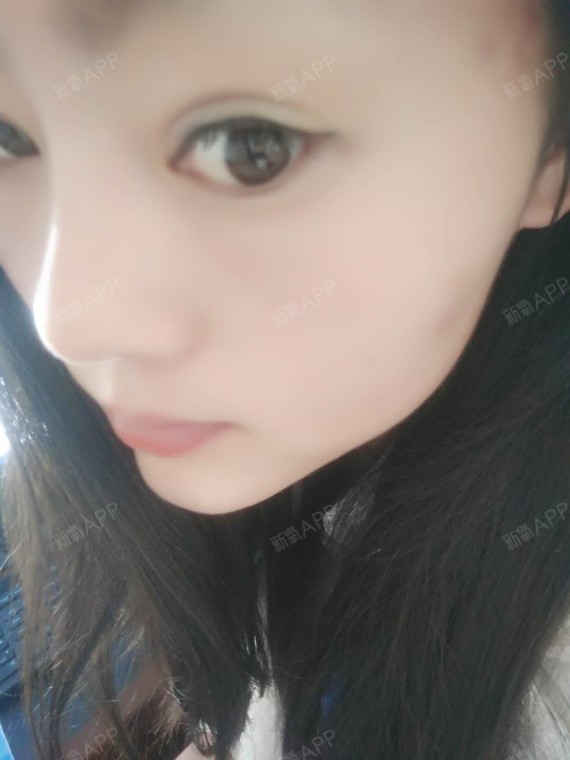 考不上大学去抗日硅胶隆鼻第43天美丽日记-新