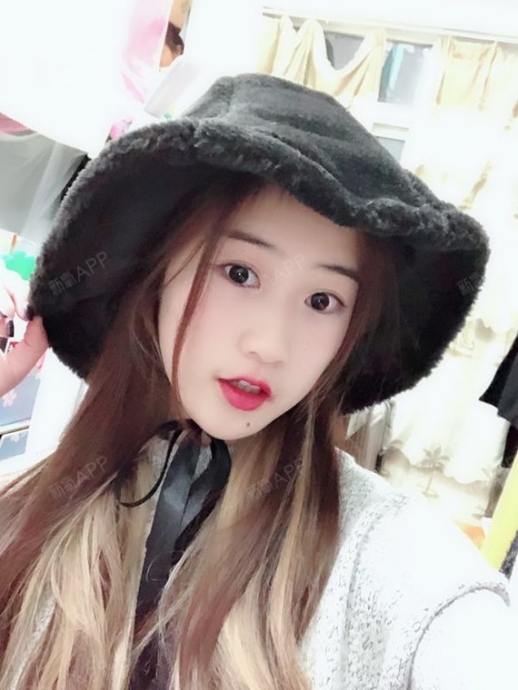 妖娆装饰唇彩切开双眼皮第24天美丽日记-新氧