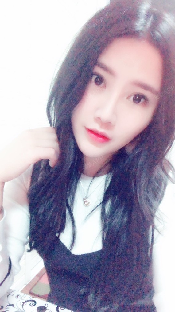 阳阳小公举自体脂肪丰太阳穴第227天美丽日记