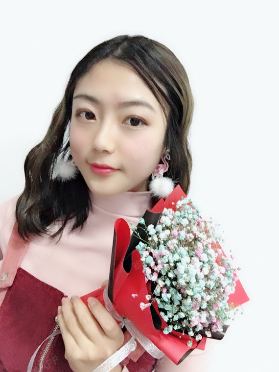 恬恬ing切开双眼皮第24天美丽日记-新氧美容整