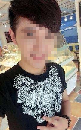 上海虹桥医院腋臭科肉毒素去狐臭第2天美丽日