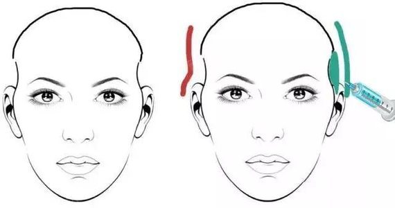 很多人脸型不够好颧骨突出年龄感十足的原因之一就是太阳穴凹陷太阳穴在面相学_圈子-新氧美容整形