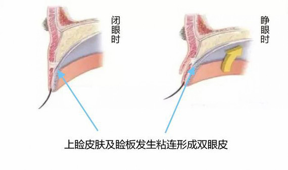 (传统手术方法原理)