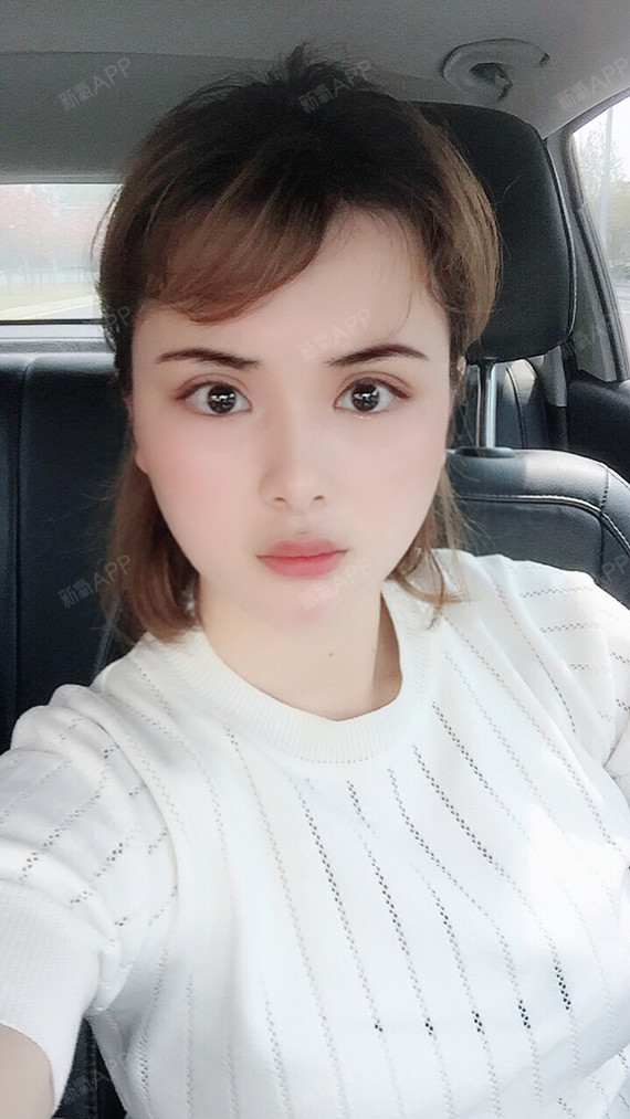 新氧- 妹妹你坐船头哥哥你岸上走 | 眼部 | 术后当自强 | 合肥同城