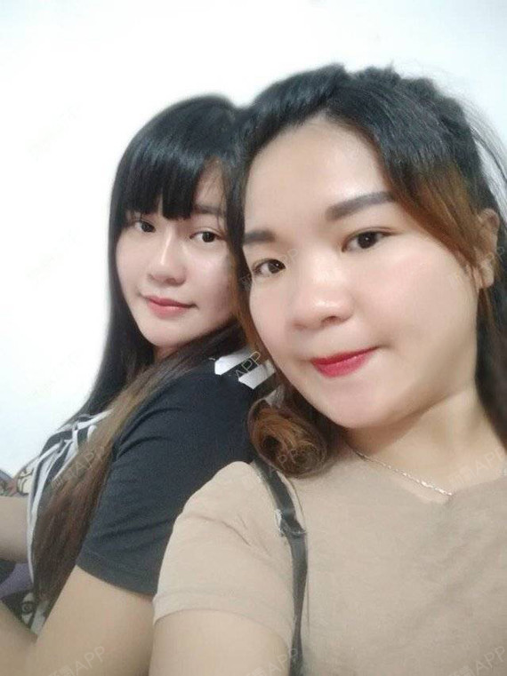 小跳蛙coco肉毒素瘦脸第21天美丽日记-新氧美