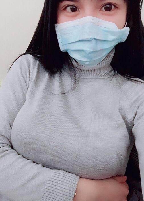 腋下的切口不大,恢复的很快,不过建议要做丰胸的宝宝可以先洗头洗澡再