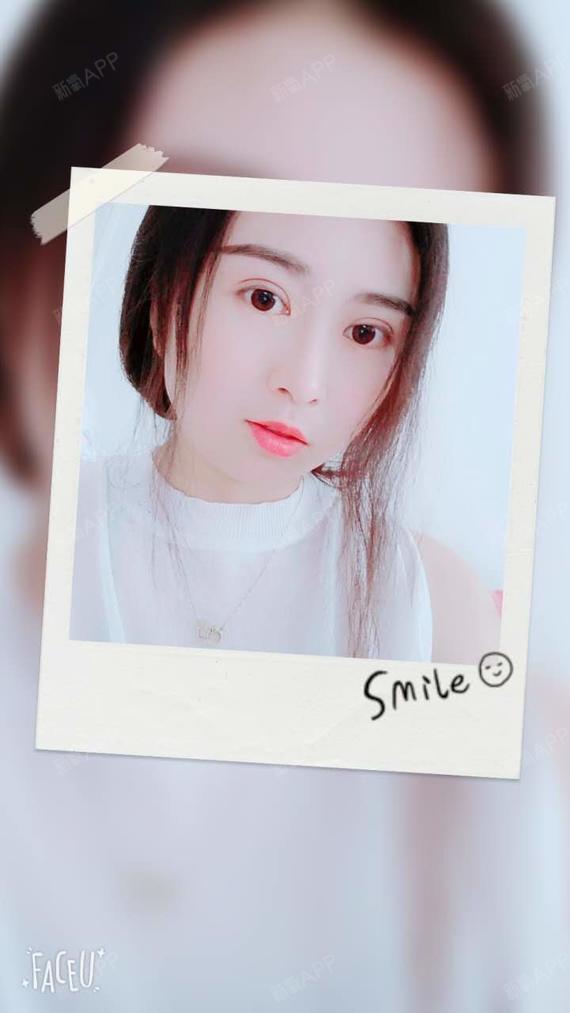 来自大草原的小羚羊水光针第30天美丽日记-新