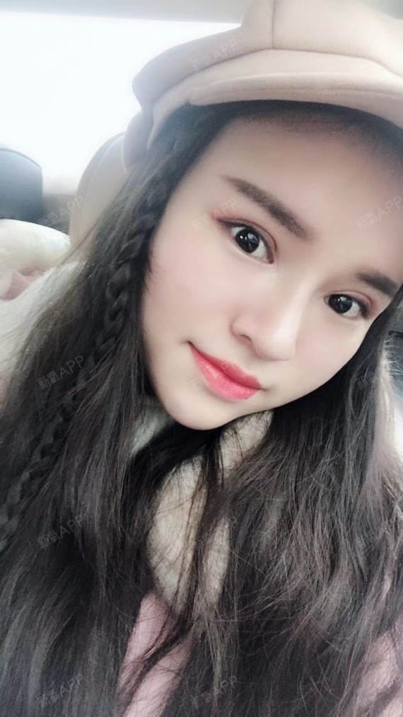 你承认吧肉毒素瘦脸第16天美丽日记-新氧美容