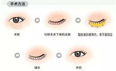 我可以去哪里进行整形手术:在哪里可以学习美容和整形手术?