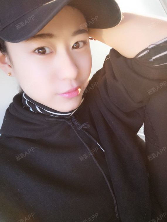 清酒桃花eag鼻部修复第70天美丽日记-新氧美