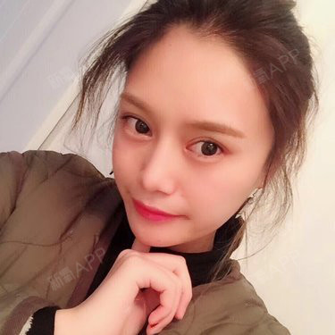 偷吃的布朗熊鼻综合第211天美丽日记-新氧美容