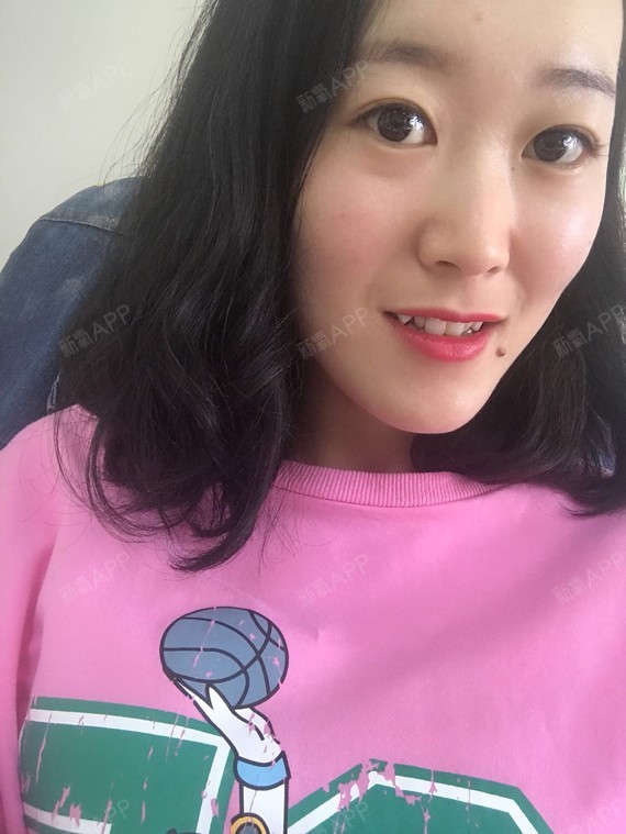 北京叶美人医疗美容医院 内切去眼袋术后九天