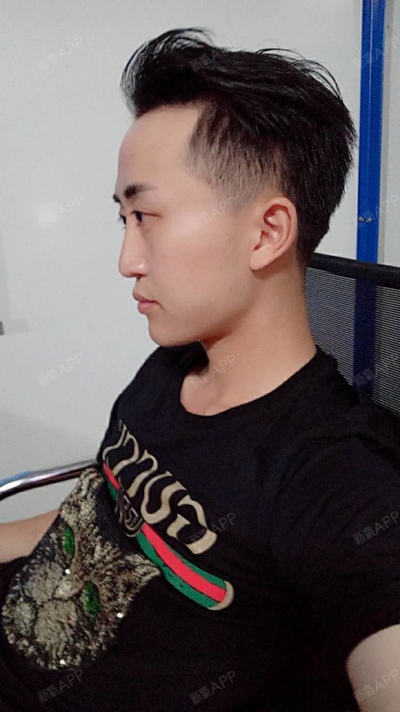 非常完美123硅胶垫下巴第73天美丽日记-新氧