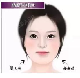 瘦脸针真的有用吗?为什么打完没效果?今天_圈