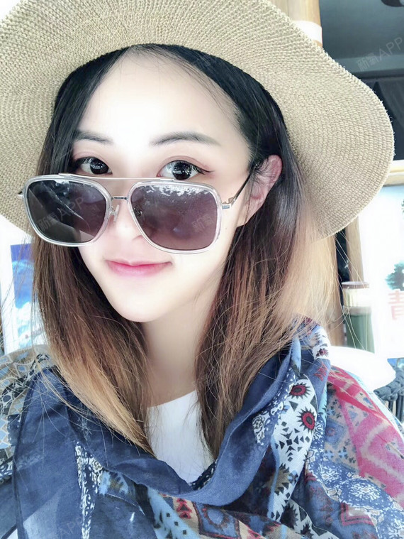 玲子最美埋线双眼皮第243天美丽日记-新氧美容